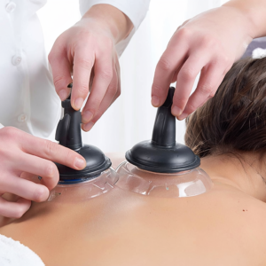 tratamento com ventosas - marcia costa fisioterapia