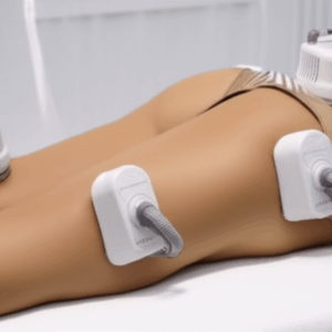 Criolipolise - Dra Cris de Paula Biomédica