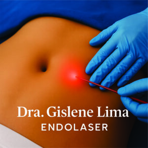 Endolaser: Tecnologia a laser para redução de gordura localizada, melhora da celulite e firmeza da pele