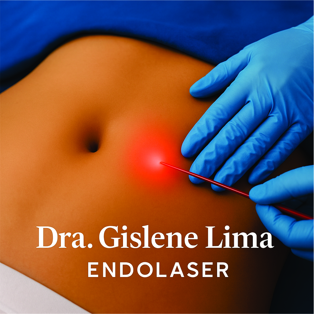 Endolaser: Tecnologia a laser para redução de gordura localizada, melhora da celulite e firmeza da pele